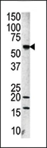 ANTI-AURORA-A(C-TERMINAL) antibody produced in rabbit