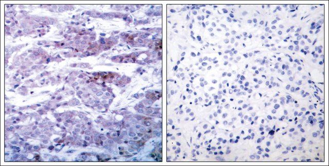 Anti-BAD (Ab-112) antibody produced in rabbit