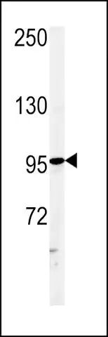 ANTI-ATXN2L (C-TERM) antibody produced in rabbit