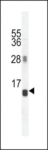 ANTI-AVPI1(N-TERMINAL) antibody produced in rabbit