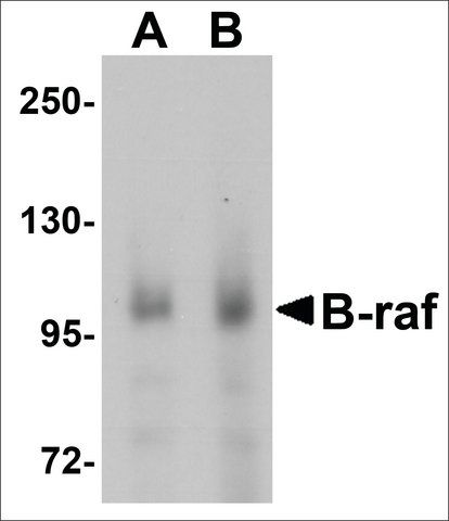 Anti-B-RAF antibody produced in rabbit