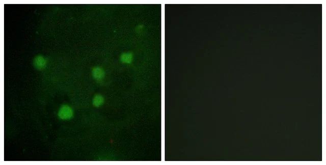 Anti-BAF250B antibody produced in rabbit