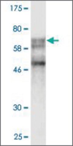 Monoclonal Anti-SSB antibody produced in mouse