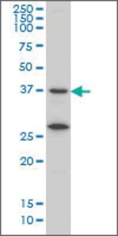 Monoclonal Anti-SPINLW1 antibody produced in mouse