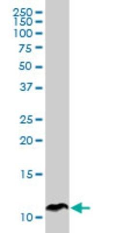 Monoclonal Anti-SPINK1, (C-terminal) antibody produced in mouse