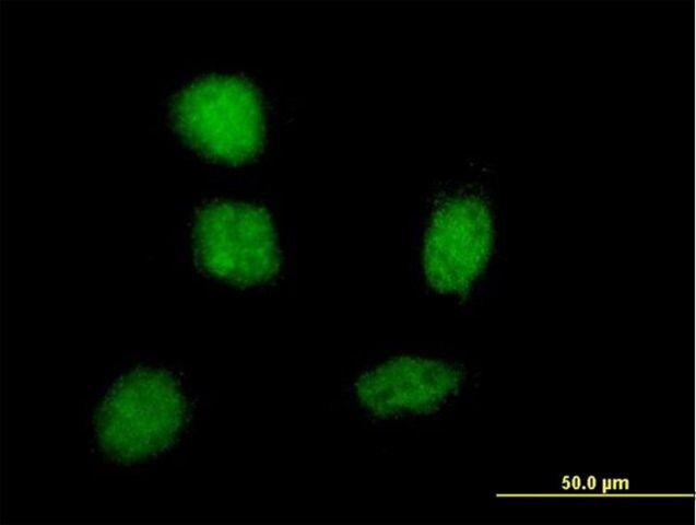 Monoclonal Anti-SOX21 antibody produced in mouse