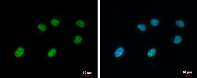 Monoclonal Anti-STAG1 antibody produced in mouse