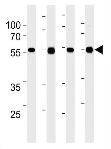 MONOCLONAL ANTI-TPIPB(C-TERMINAL) antibody produced in mouse