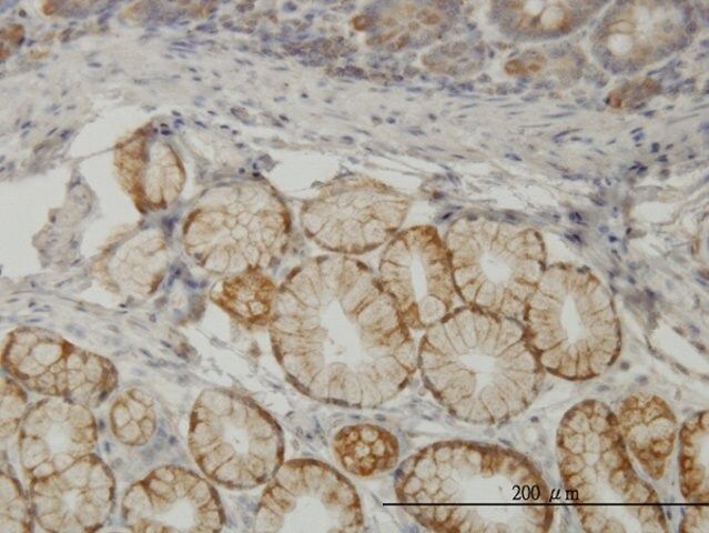 Monoclonal Anti-TLN1 antibody produced in mouse