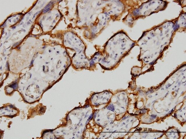 Monoclonal Anti-TFRC antibody produced in mouse