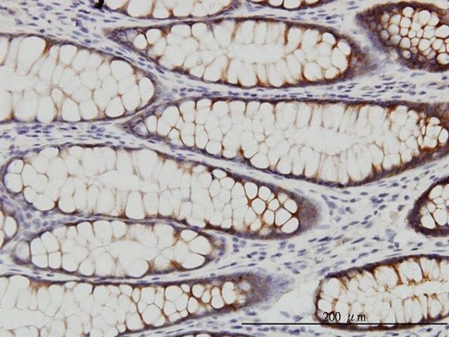 Monoclonal Anti-WNK2 antibody produced in mouse