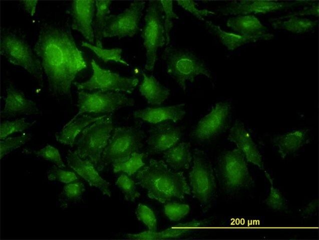 Monoclonal Anti-TSC22D1 antibody produced in mouse