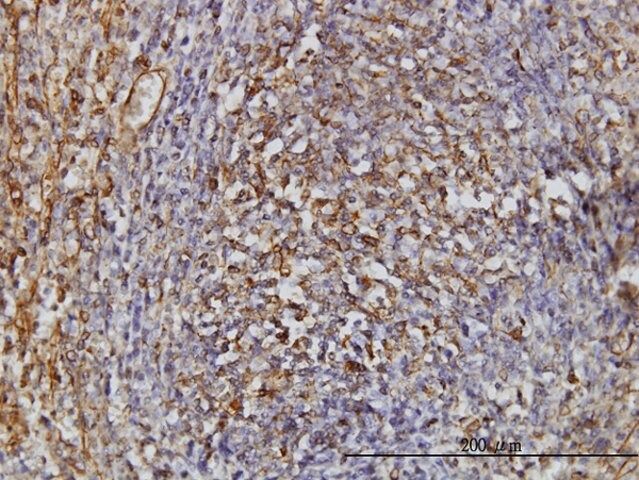 Monoclonal Anti-TPMT antibody produced in mouse