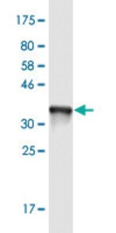 Monoclonal Anti-TTPA antibody produced in mouse