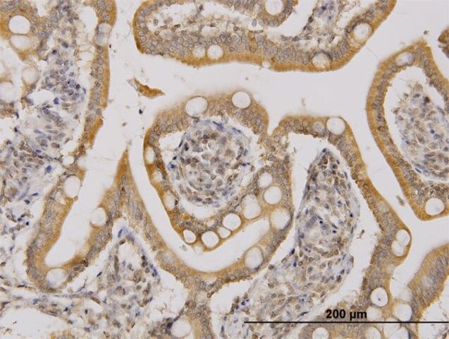 Monoclonal Anti-UBE2D2 antibody produced in mouse