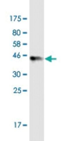 Monoclonal Anti-TTC9C antibody produced in mouse