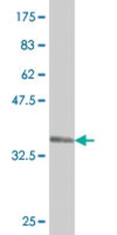 Monoclonal Anti-WDR36 antibody produced in mouse