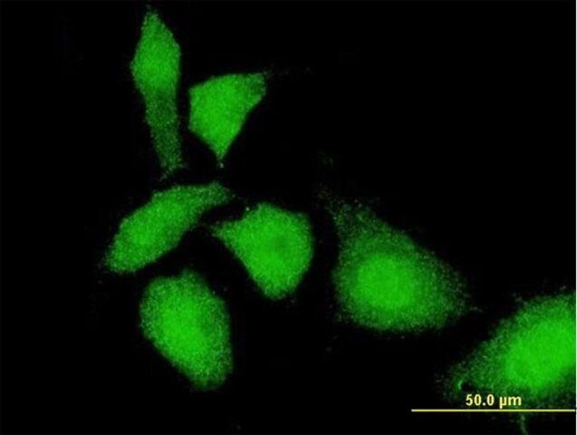 Monoclonal Anti-TKTL1 antibody produced in mouse