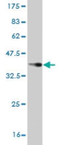 Monoclonal Anti-ZIC3 antibody produced in mouse