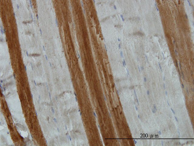 Monoclonal Anti-TOM1 antibody produced in mouse