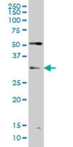 Monoclonal Anti-TLX3 antibody produced in mouse