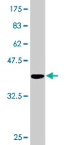 Monoclonal Anti-TTC4, (N-terminal) antibody produced in mouse