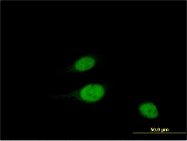 Monoclonal Anti-WBSCR22 antibody produced in mouse