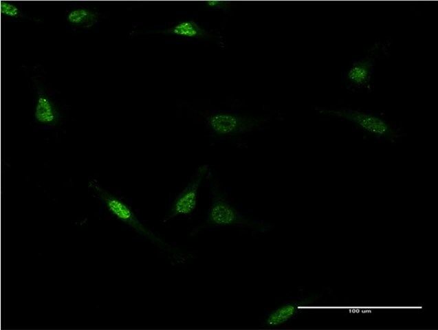 Monoclonal Anti-ZNF76, (C-terminal) antibody produced in mouse