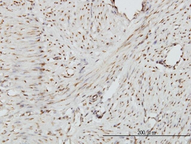 Monoclonal Anti-ZHX2 antibody produced in mouse