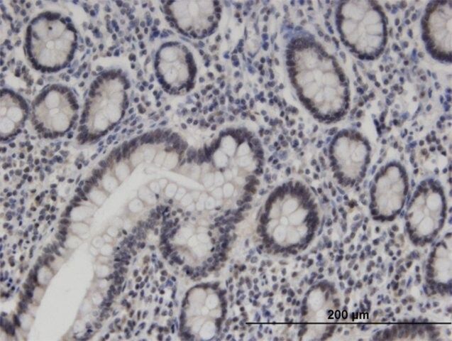 Monoclonal Anti-ZNF138 antibody produced in mouse