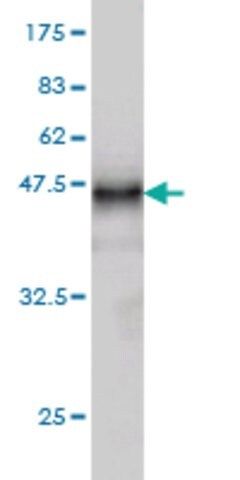 Monoclonal Anti-LTBP2 antibody produced in mouse