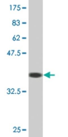 Monoclonal Anti-LRAT antibody produced in mouse