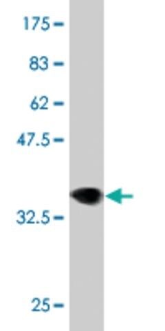 Monoclonal Anti-LRRK2 antibody produced in mouse