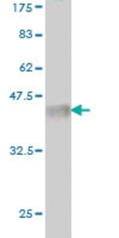 Monoclonal Anti-LRRFIP1 antibody produced in mouse