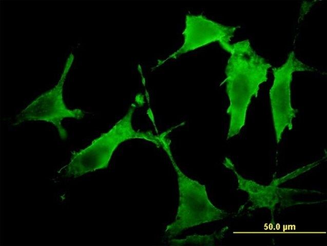 Monoclonal Anti-PAK3, (N-terminal) antibody produced in mouse