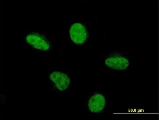 Monoclonal Anti-PCAF antibody produced in mouse