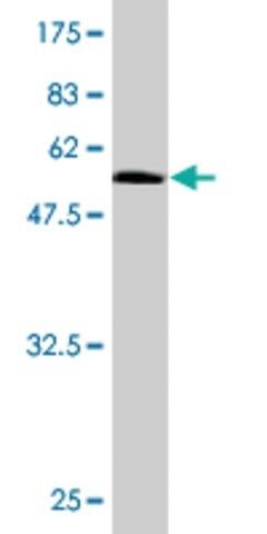 Monoclonal Anti-RAD51L3 antibody produced in mouse