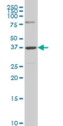 Monoclonal Anti-RDHE2 antibody produced in mouse