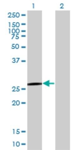 Monoclonal Anti-QDPR antibody produced in mouse