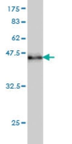 Monoclonal Anti-RAD17 antibody produced in mouse