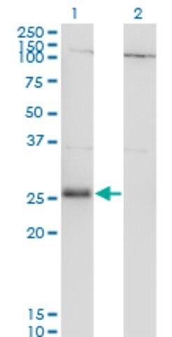 Monoclonal Anti-RNF138 antibody produced in mouse