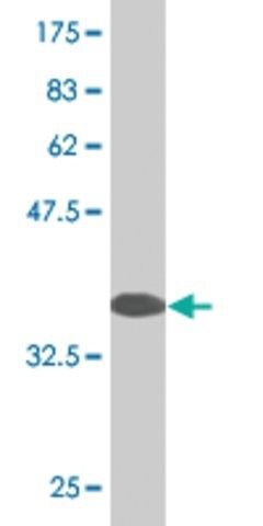 Monoclonal Anti-RASD2 antibody produced in mouse