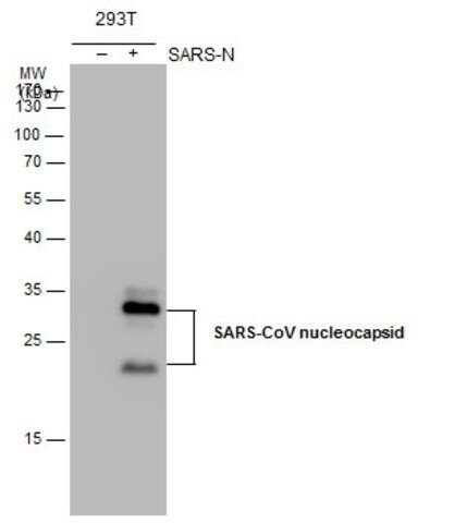 Monoclonal Anti-SARS-CoV Nucleocapsid antibody produced in mouse