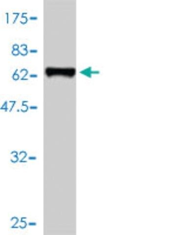 Monoclonal Anti-RCN1 antibody produced in mouse