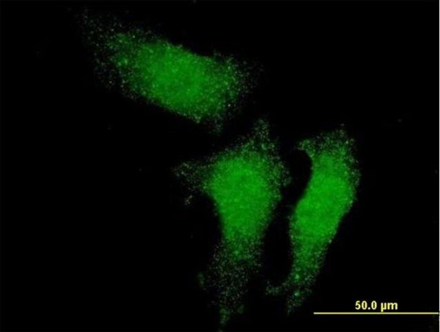 Monoclonal Anti-RUVBL1 antibody produced in mouse