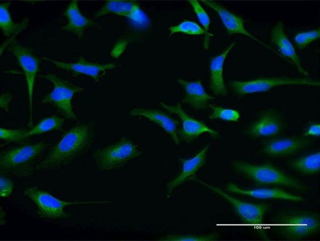 Monoclonal Anti-ABCG1 antibody produced in mouse