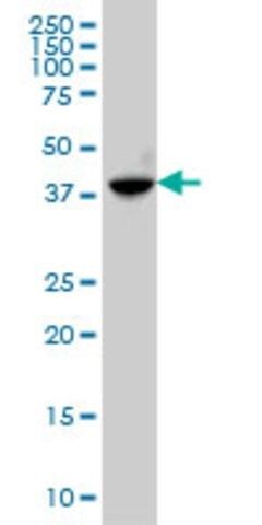 Monoclonal Anti-ABHD5 antibody produced in mouse