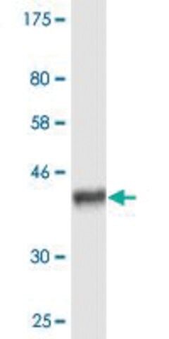 Monoclonal Anti-ABCC8 antibody produced in mouse