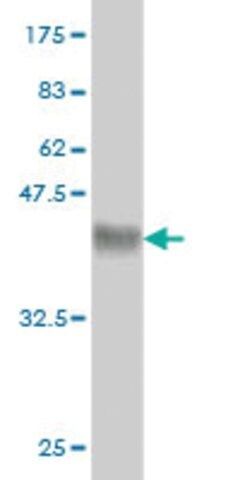 Monoclonal Anti-ARMC8 antibody produced in mouse