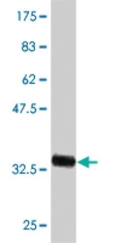 Monoclonal Anti-ADK antibody produced in mouse